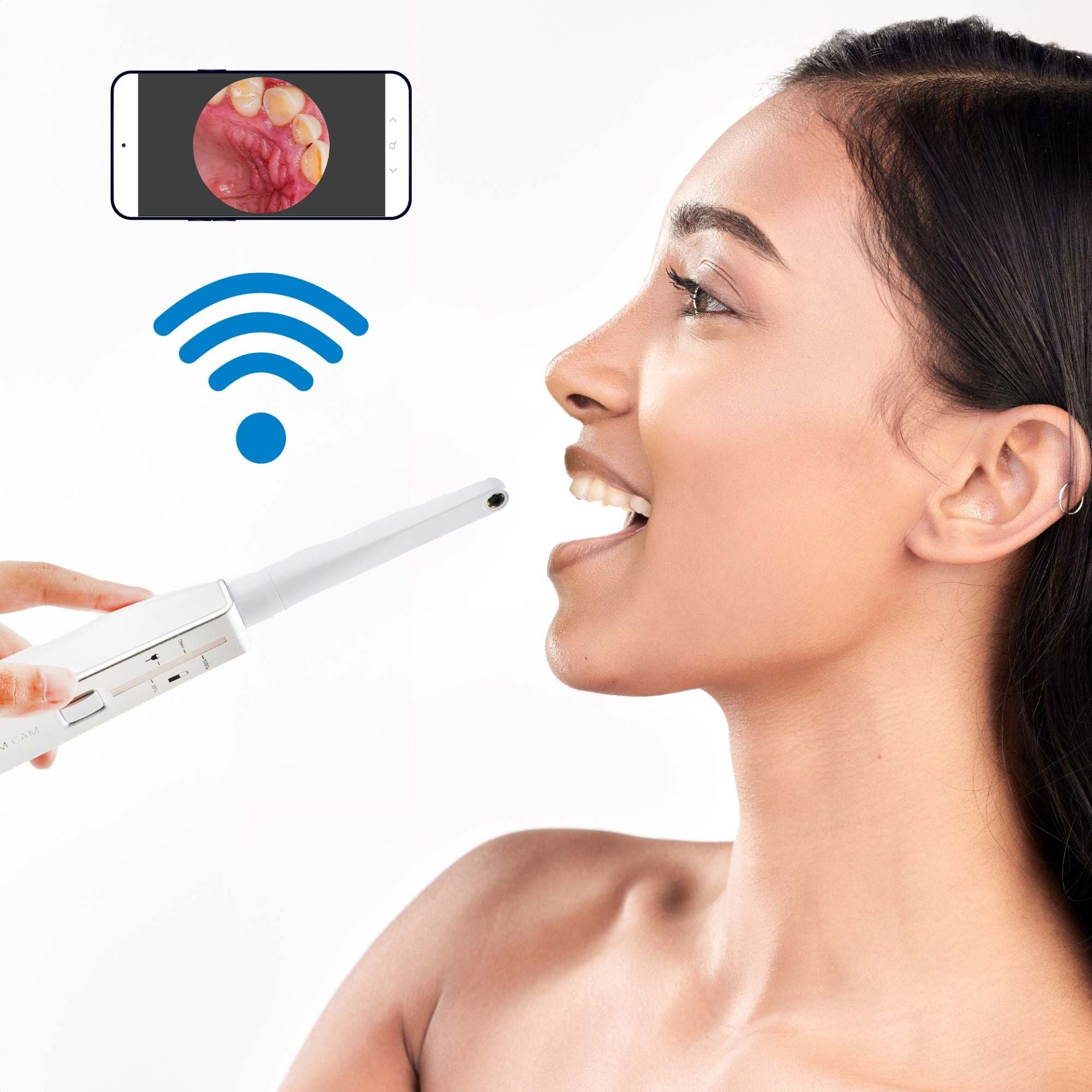 Accesorio de cámara dental PlatinumCAM
