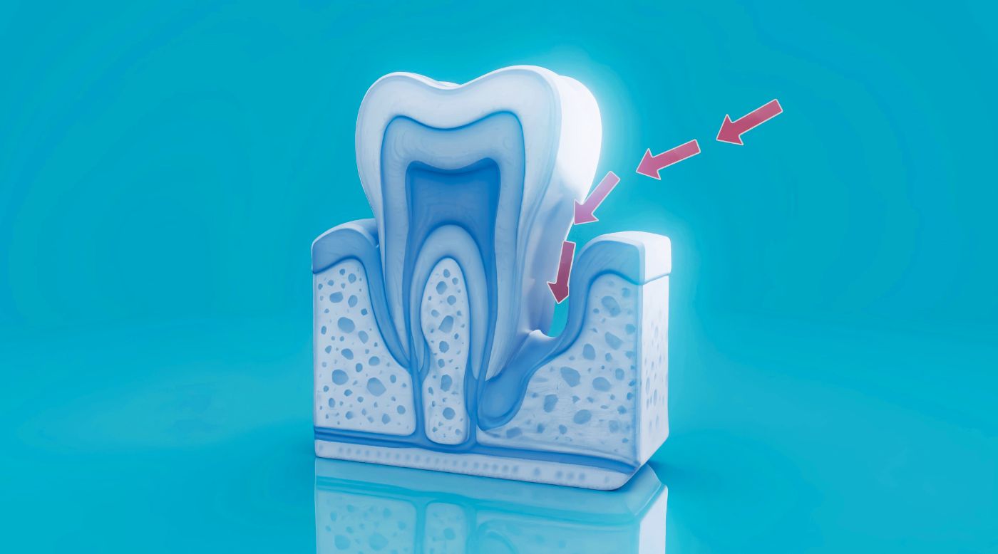 Warum dein Zahnfleisch zurückgeht – erste Anzeichen erkennen